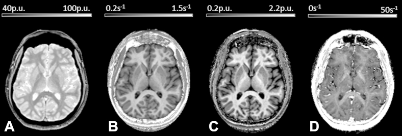 Fig. 1