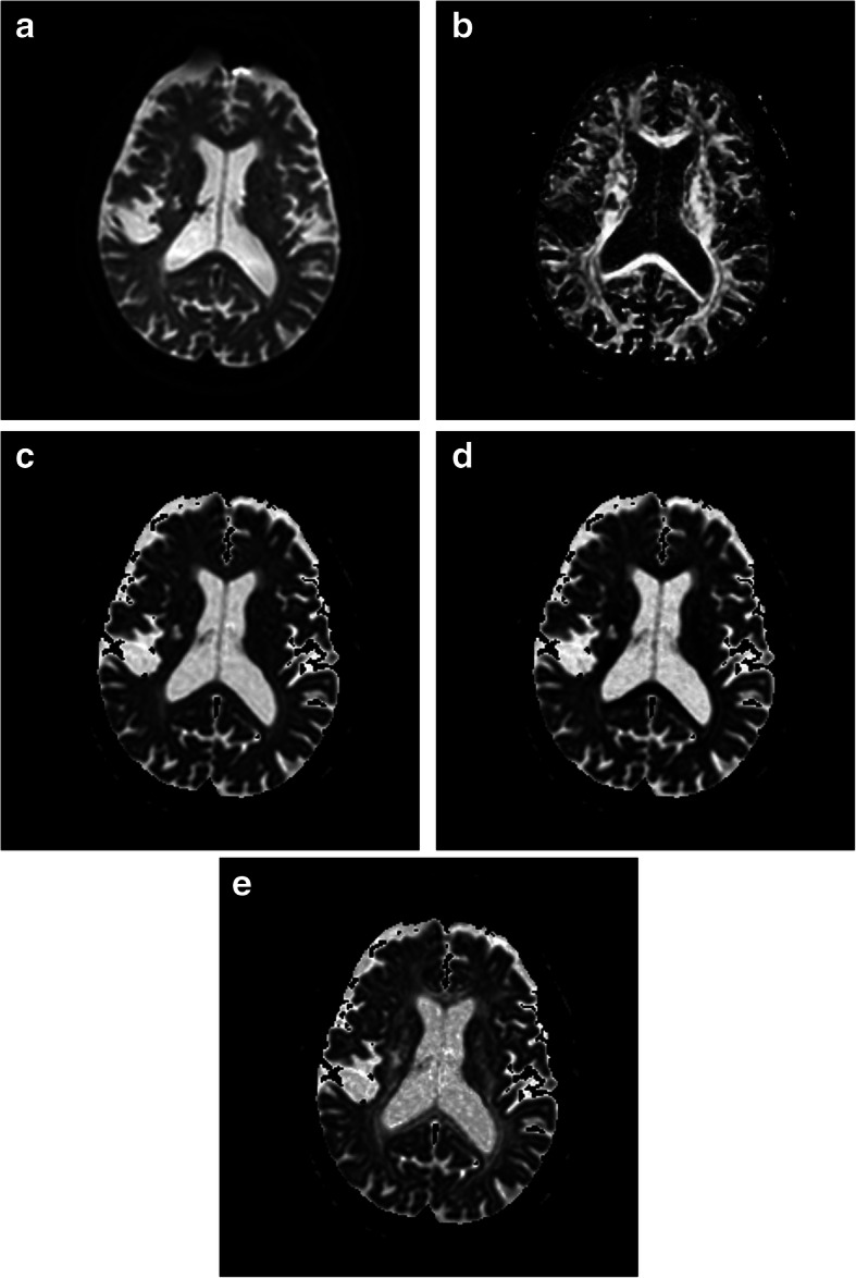 Fig. 7