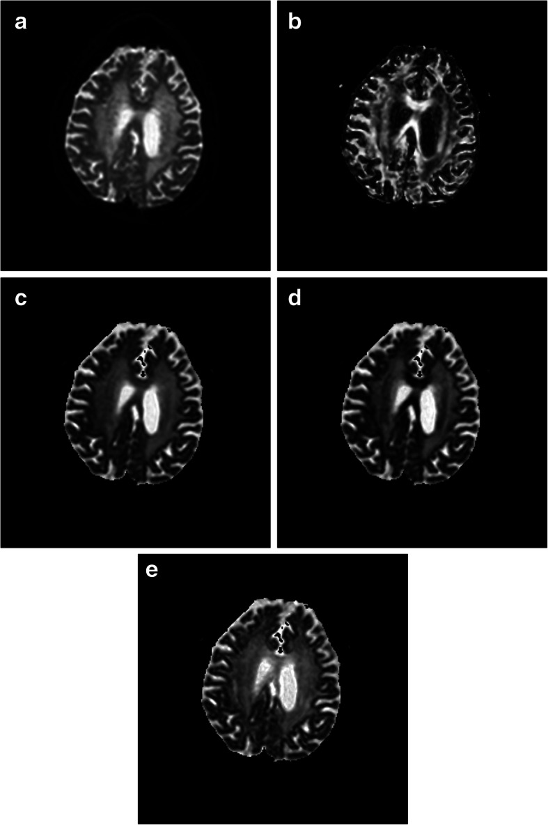 Fig. 9