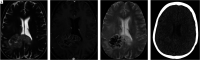 FIG 2.