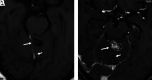 FIG 10.