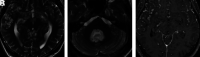 FIG 5.