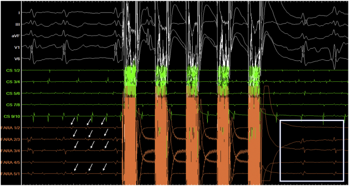 Figure 4