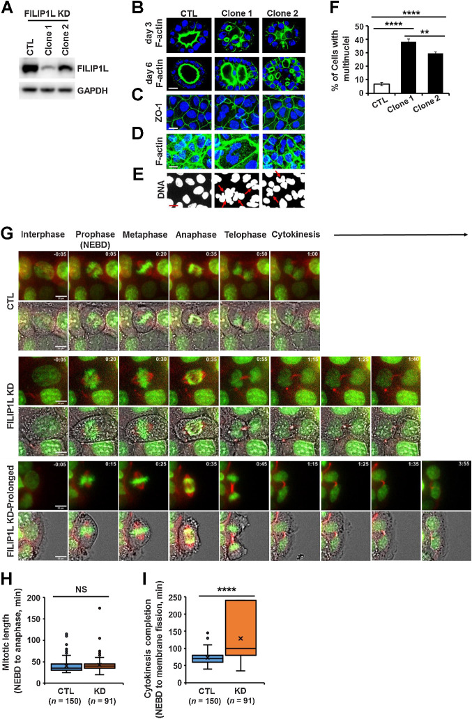 Figure 4. FILIP1L knockdown results in defective cytokinesis. A, FILIP1L knockdown was achieved by CRISPR-Cas9 system in MDCK.2 cells. FILIP1L and GAPDH control were detected by immunoblotting. Two independent clones were tested. B, MDCK.2 clones were grown in the presence of Matrigel, and three-dimensional cysts were imaged following staining for F-actin and nuclei at days 3 and 6. C–F, MDCK.2 clones were grown in monolayer and stained for Z0–1 (C), F-actin (D), and DNA (E). F, Clones were stained for Z0–1 and DNA, and the number of cells with multinuclei were quantified. Over 400 cells were counted. G–I, Time-lapse imaging of Caco2 clones that were incubated with SPY-595 DNA and SPY-650-tubulin fluorescent dyes. G, Representative tiled images of mitotic progression in control and FILIP1L knockdown clones. FILIP1L knockdown clones exhibiting prolonged cytokinesis are also shown (third panel). Within each panel of tiled images, the top strip shows fluorescent images only and the bottom strip shows fluorescent images overlaid with phase contrast. Scale bar, 20 μm. H and I, Mitotic length (H) and cytokinesis completion (I) from control and FILIP1L knockdown clones were quantified from three independent experiments. **, P < 0.01; ****, P < 0.0001; NS, nonsignificant.