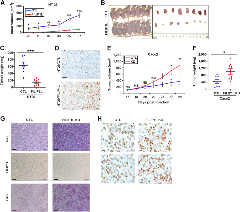 Figure 1. FILIP1L levels affect colon xenograft tumor growth, and its knockdown induces mucin secretion as well as multinucleation in colon xenograft tumors. A, HT29 (1.5 × 106) clones of either control or FILIP1L+ derivatives were subcutaneously injected into the nude mice (8 mice per cell line). Tumor growth was measured, every 2 to 3 days for a total of 37 days. The y-axis represents tumor volume that was calculated by the formula: (length × width × height × 0.52). B and C, Pictures of mice and HT29 xenograft tumors at the time of sacrifice (B) as well as tumor weights (C) are shown. D, HT29 xenograft tumors from either control or FILIP1L+ derivatives were fixed and IHC stained for FILIP1L. E–H, Caco2 (5 × 106) clones of either control or FILIP1L-knockdown derivatives were subcutaneously injected into the nude mice (8 mice per cell line). E and F, Tumor growth (E) was measured every 2 to 3 days for a total of 29 days, as described in A, and tumor weights at the time of sacrifice (F) were measured. G, Caco2 xenograft tumors from either control or FILIP1L-knockdown derivatives were fixed and stained with H&E and PAS. They were also IHC stained for FILIP1L. Scale bar, 50 μm. H, Enlarged images of Ki67-stained Caco2 xenograft tumors from either control or FILIP1L-knockdown derivatives are shown. Arrows, clumpy multinucleated cells. Scale bar, 10 μm. *, P < 0.05; **, P < 0.01; ***, P < 0.001.