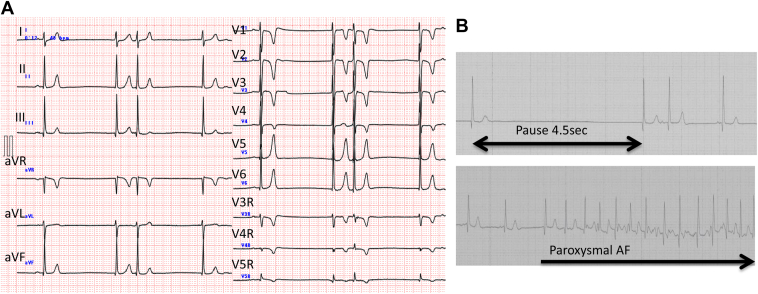 Figure 1