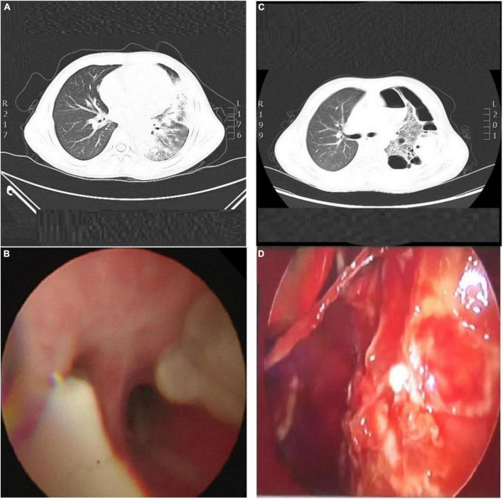 FIGURE 1