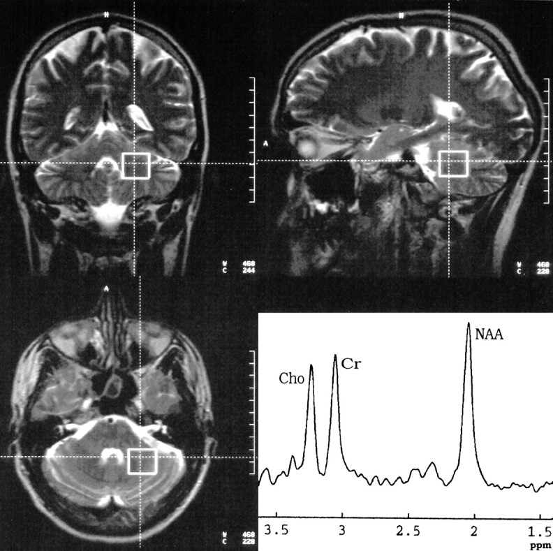 fig 2.