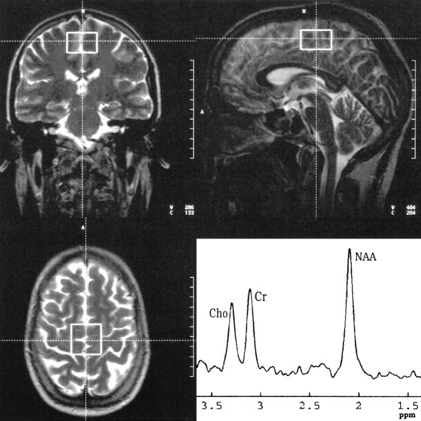 fig 1.