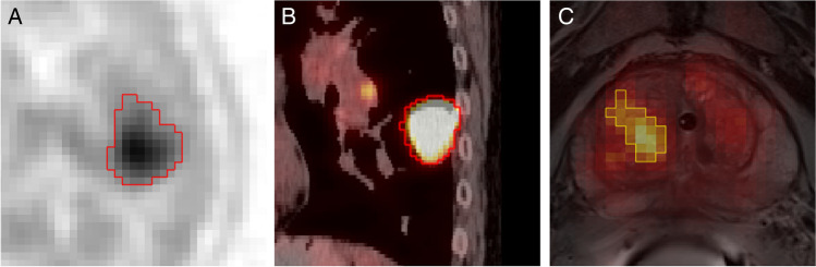 Fig. 2