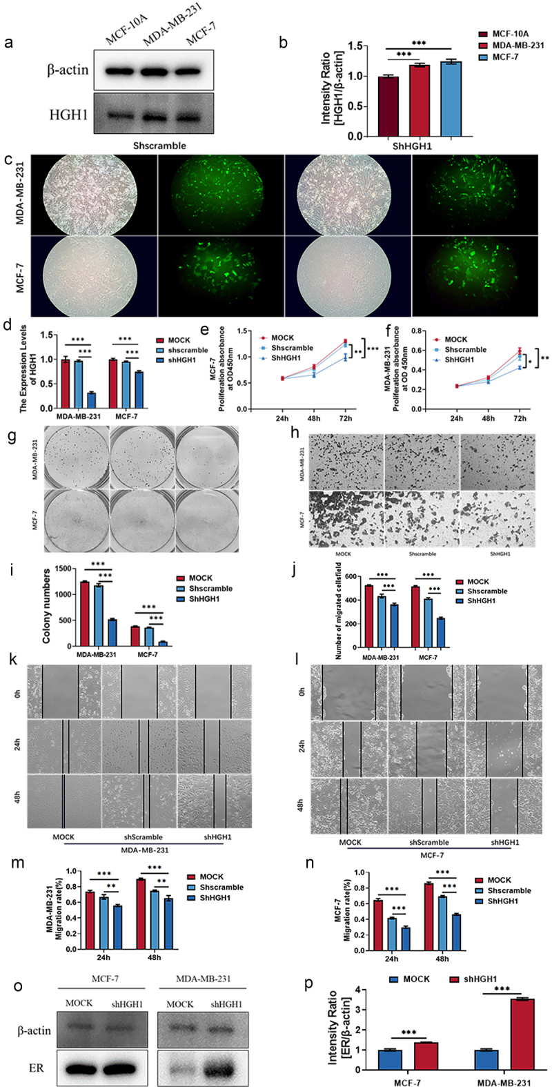 AltText: knockdown HGH1 inhibited the invasion and migration of BC cells.