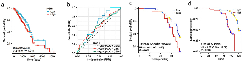 AltText: High HGH1 expression indicates poor prognosis in BRCA.