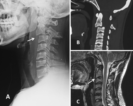 Fig. 6