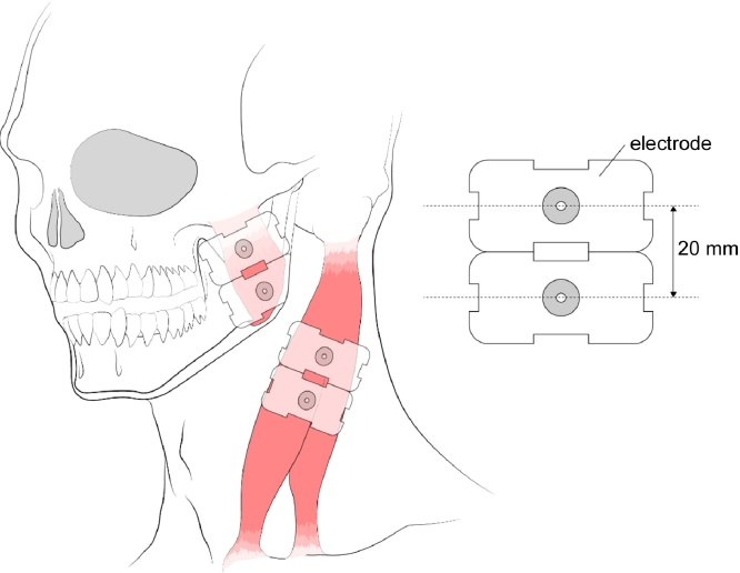 Fig. 3