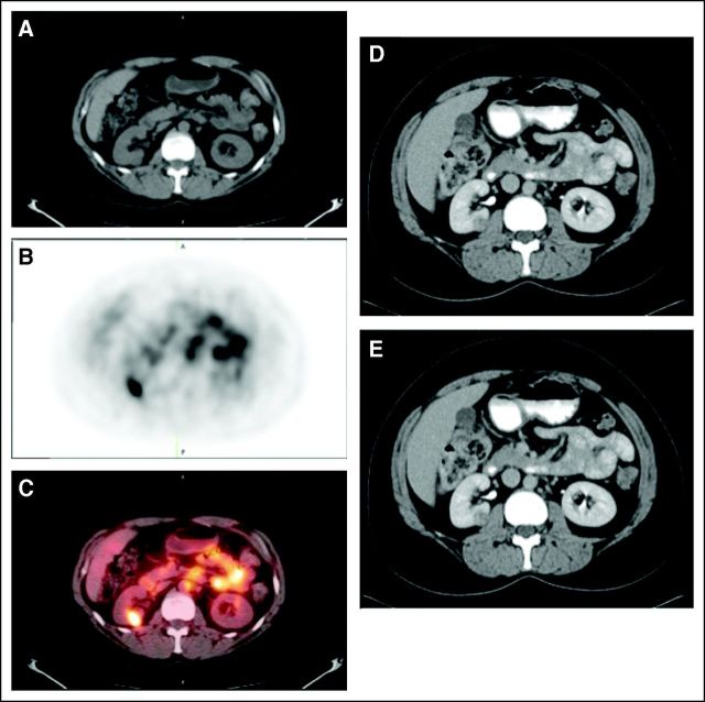 Fig 2.