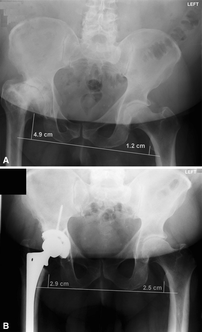 Fig. 4A–B