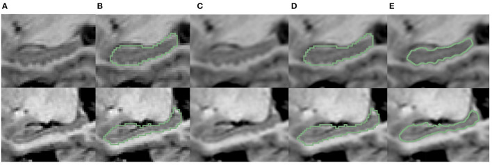 Figure 9