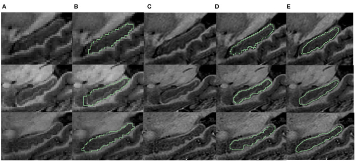 Figure 11