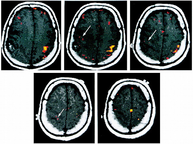 fig 1.