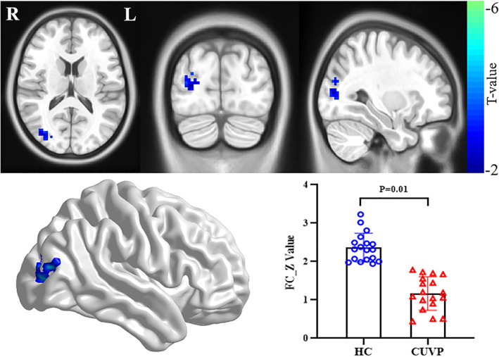 FIGURE 2