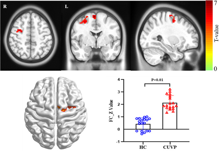 FIGURE 3