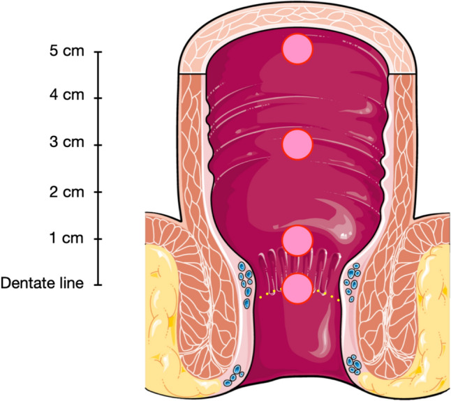 Fig. 1