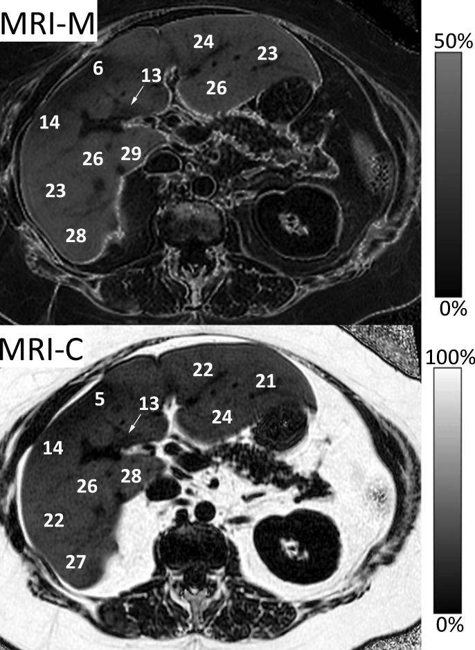 Figure 13