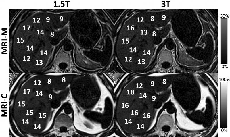 Figure 14