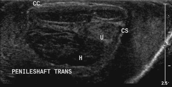 Figure 3