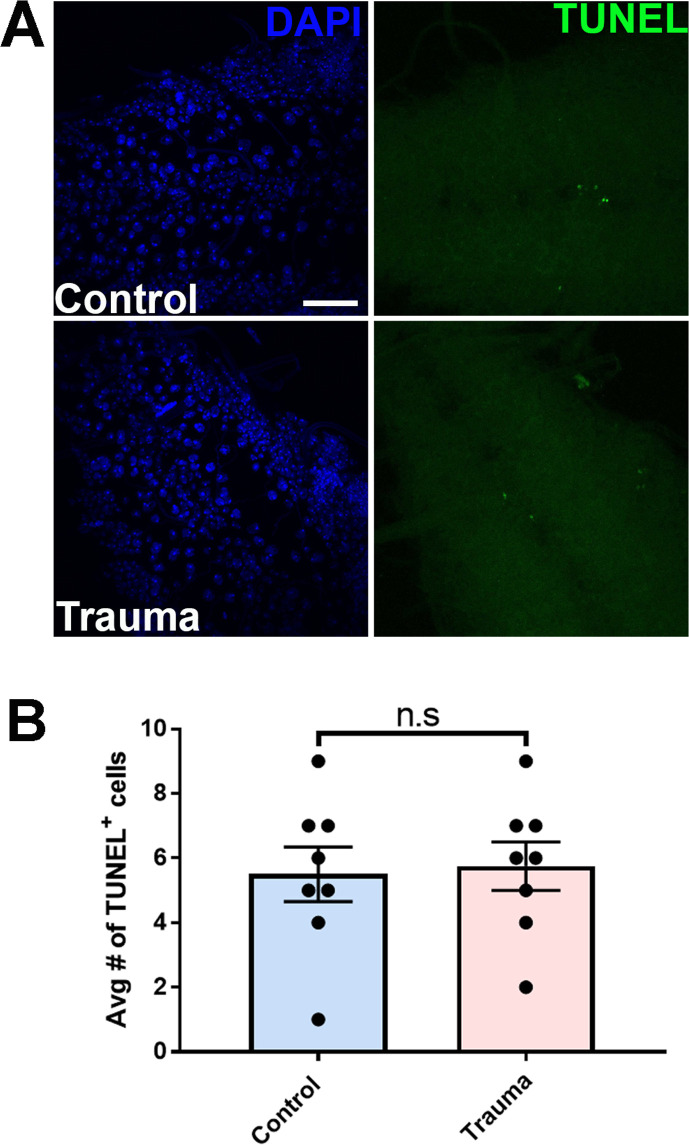 Figure 2—figure supplement 1.