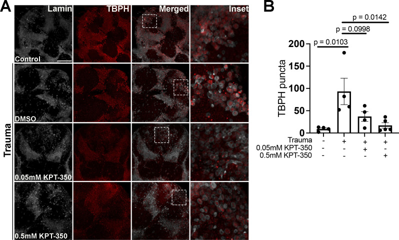 Figure 3—figure supplement 1.