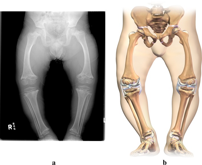 Fig. 2