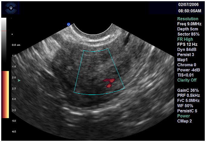 FIGURE 4