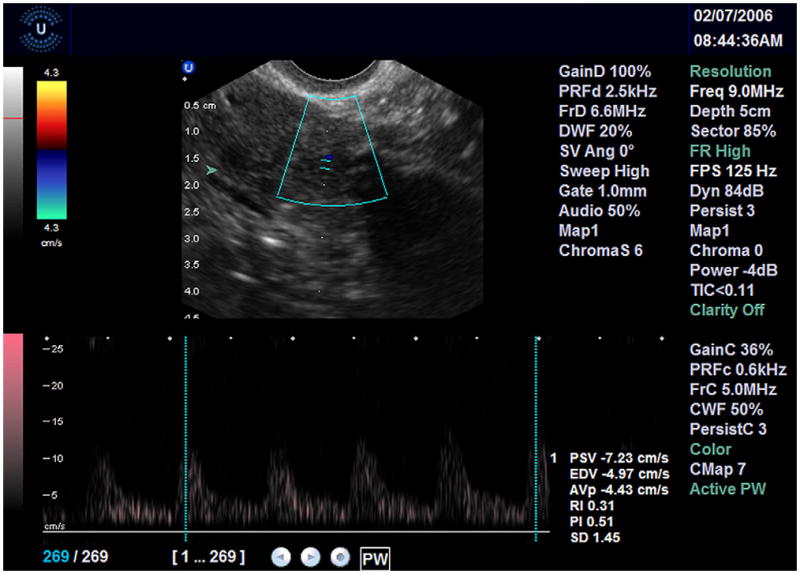 FIGURE 3