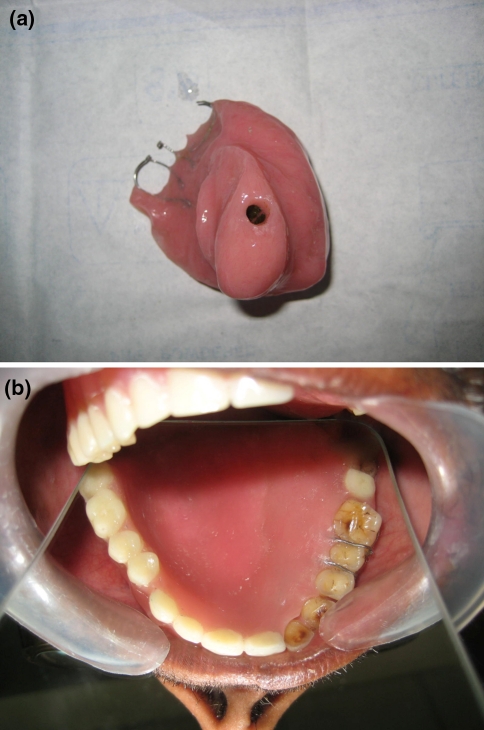 Fig. 4