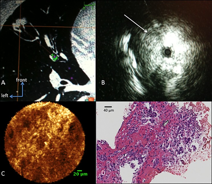 Fig 4