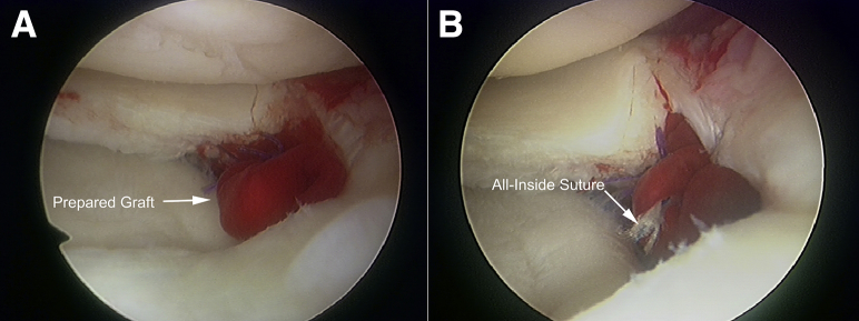 Fig 6