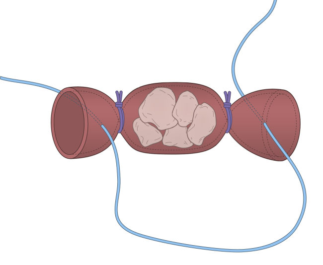 Fig 5