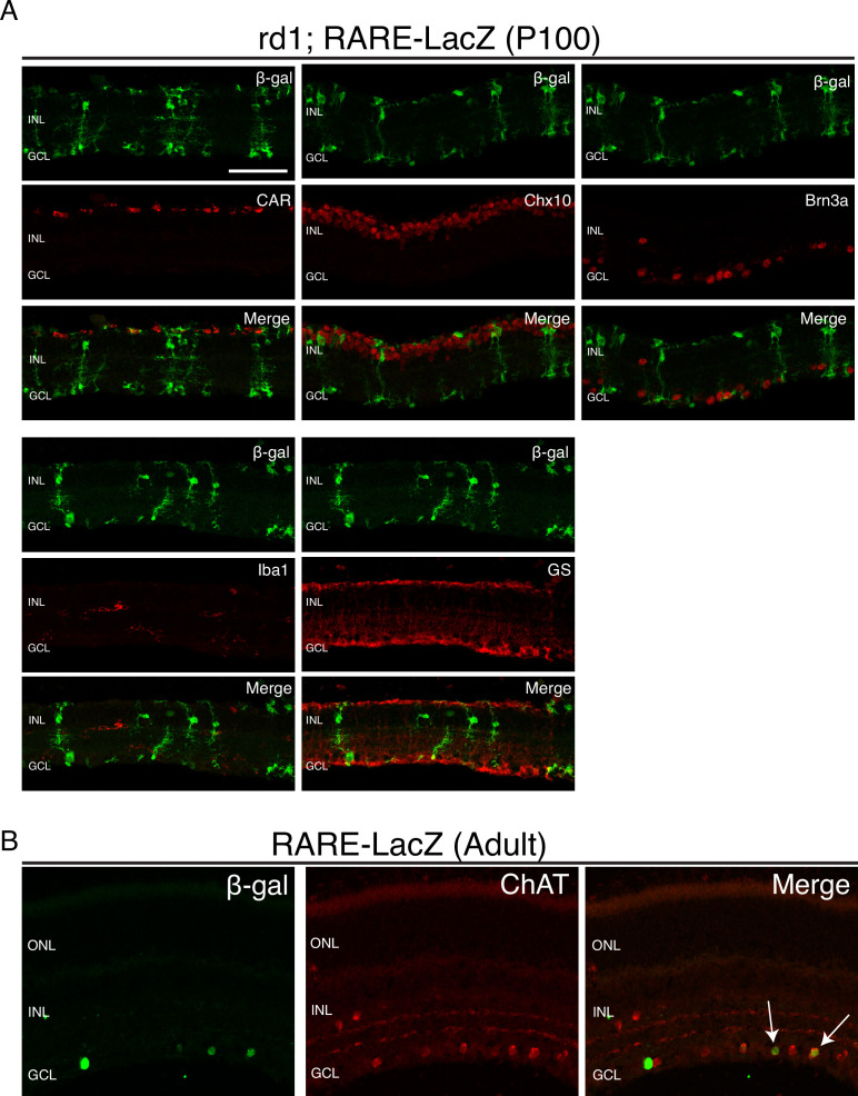 Figure 1—figure supplement 4.