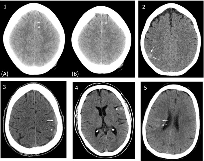 FIGURE 2