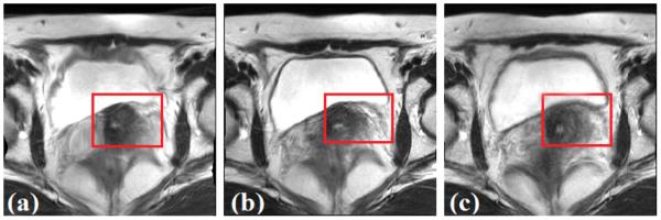 Fig. 10