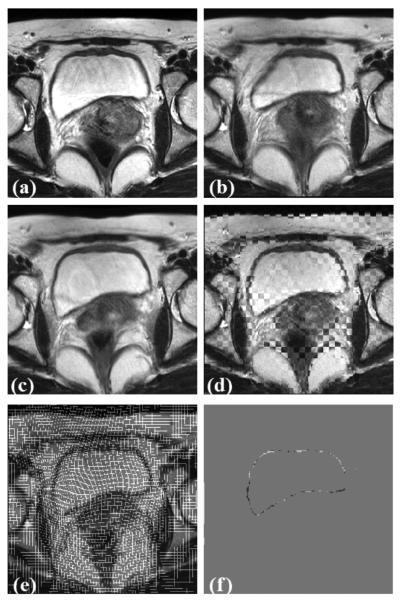 Fig. 9