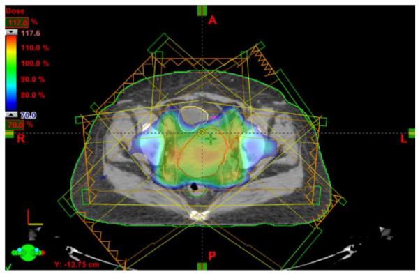 Fig. 1