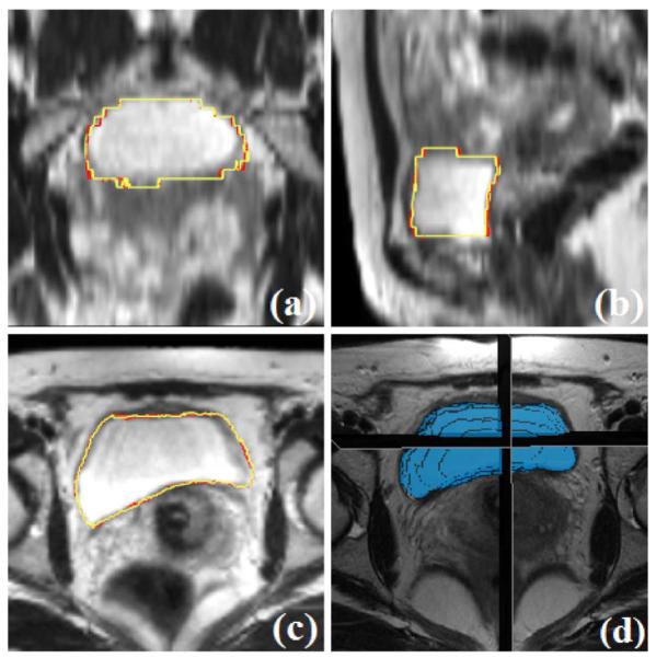 Fig. 7