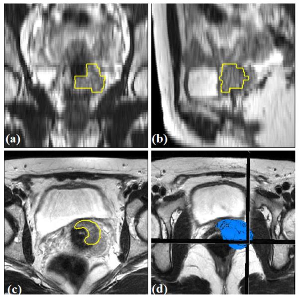 Fig. 12