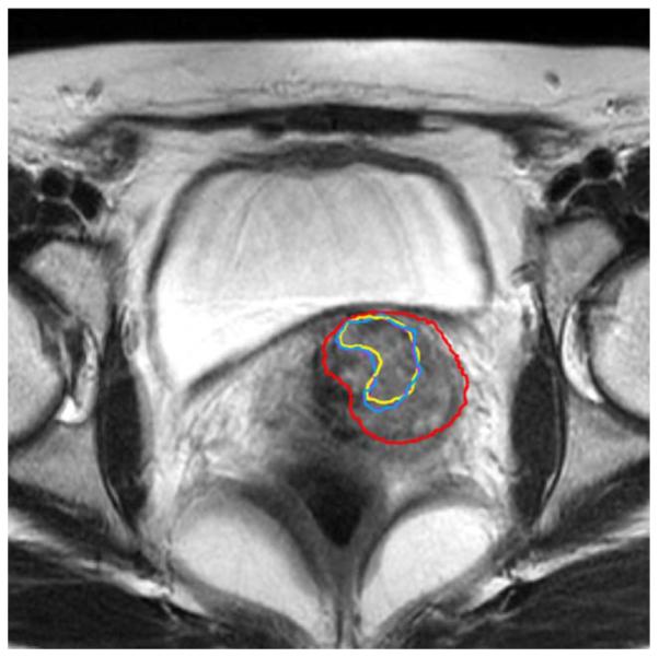 Fig. 14