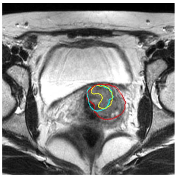 Fig. 13