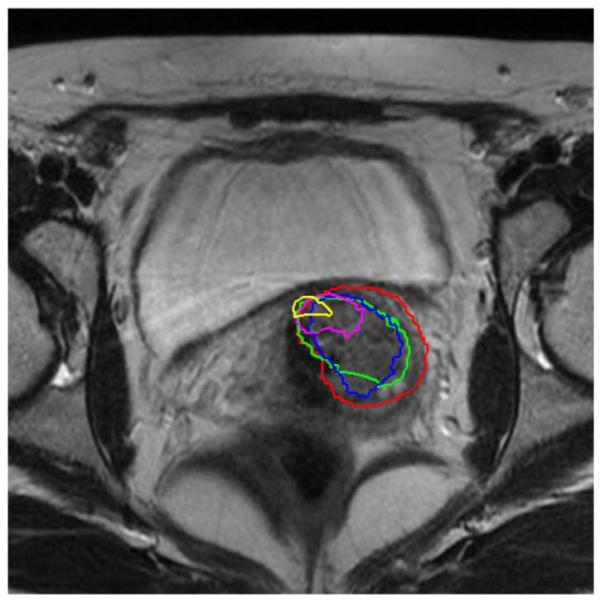 Fig. 16