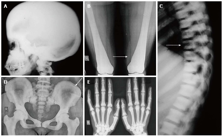 Figure 11