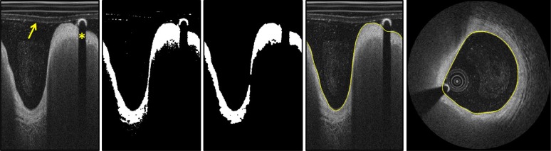 Fig. 3